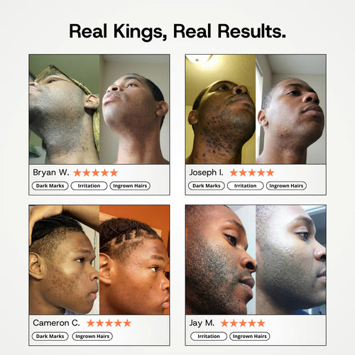 Post-Shave Ingrown Hair Serum